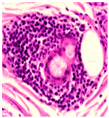 HepC-cryo_-_2