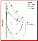 SPIROMETRIE25